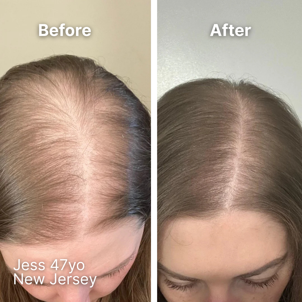 Ollea Red Light Therapy Brush